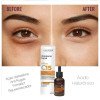 Serum Firmador Anti-Age Labotrat Dermo Skin 30Ml Nano Vitamina C